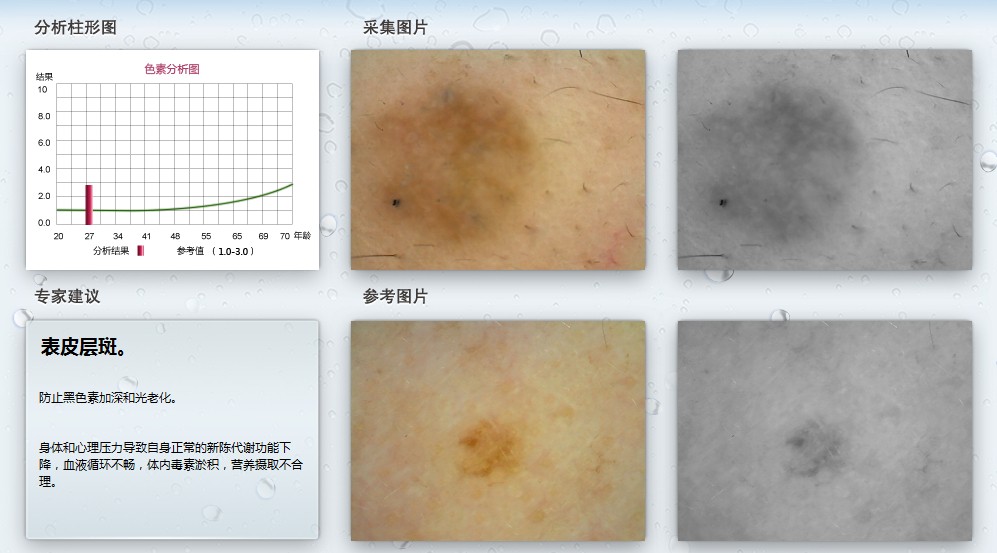 皮肤测试仪 科学护肤的智能助手