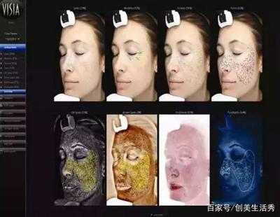 商场皮肤检测仪可信吗？科学视角下的肌肤测试真相