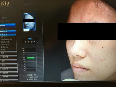 皮肤检测仪哪家强？Visia、美图宜肤、A-one实测深度对比